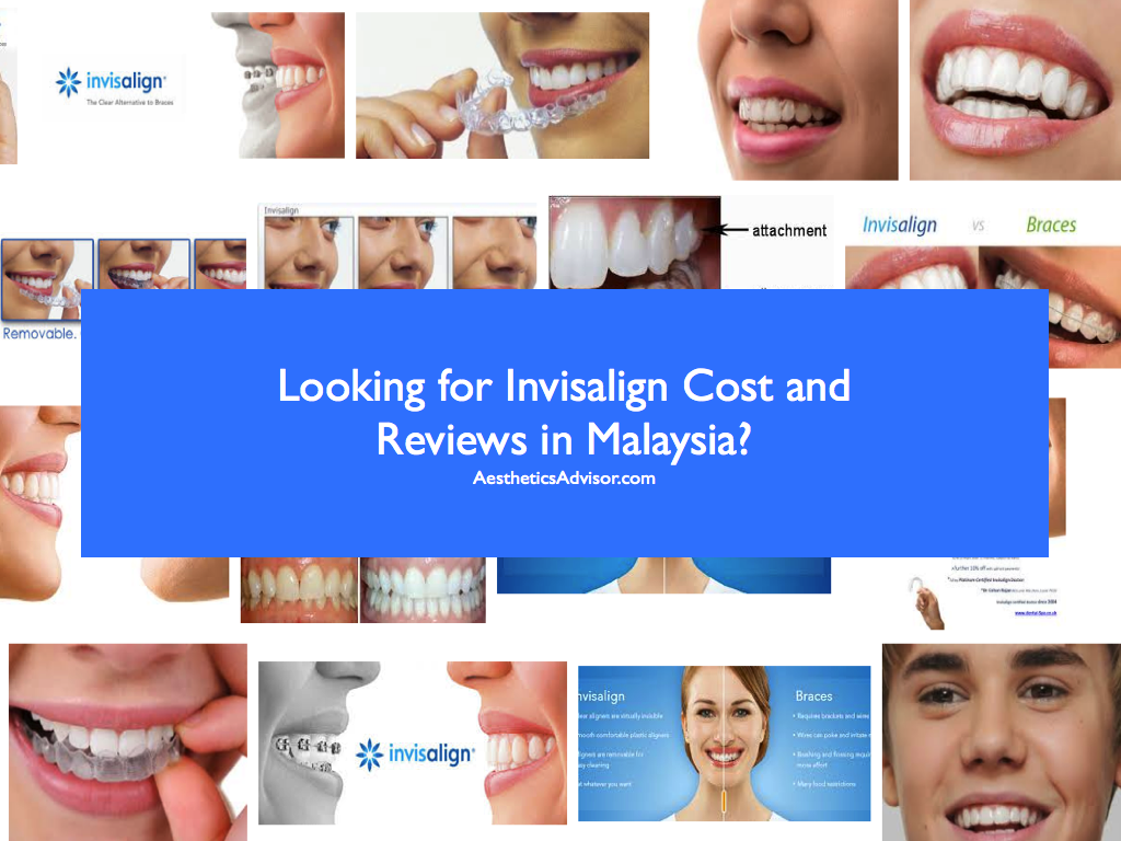 How Much Does Invisalign Cost in Canada?